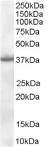 Anti-Nucleophosmin/NPM1 antibody produced in goat