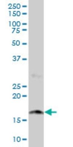 Anti-NUDT2 antibody produced in mouse