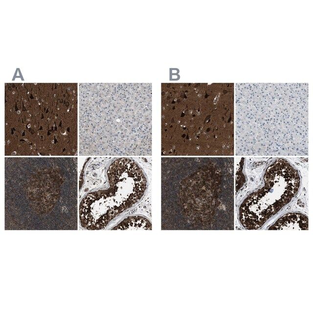 Anti-NUDCD3 antibody produced in rabbit
