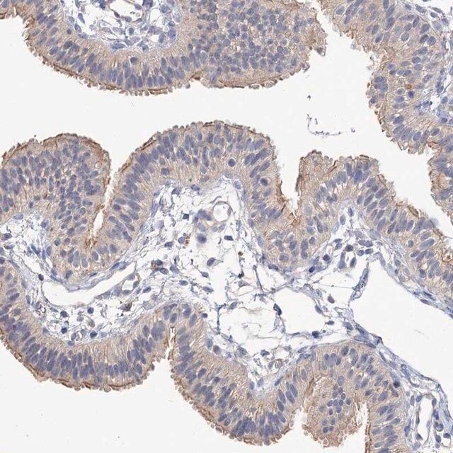Anti-NUDCD2 antibody produced in rabbit