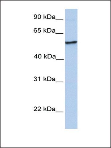 Anti-NUDCD1 antibody produced in rabbit