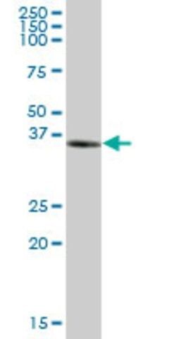 Anti-NUDT9 antibody produced in mouse