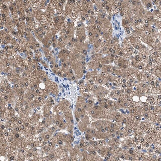 Anti-NUDT5 antibody produced in rabbit