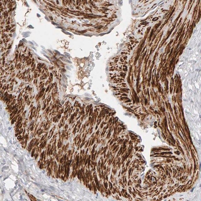 Anti-NUDCD1 antibody produced in rabbit