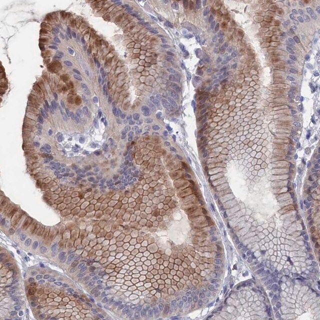 Anti-NUTF2 antibody produced in rabbit