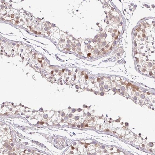 Anti-NUP188 antibody produced in rabbit