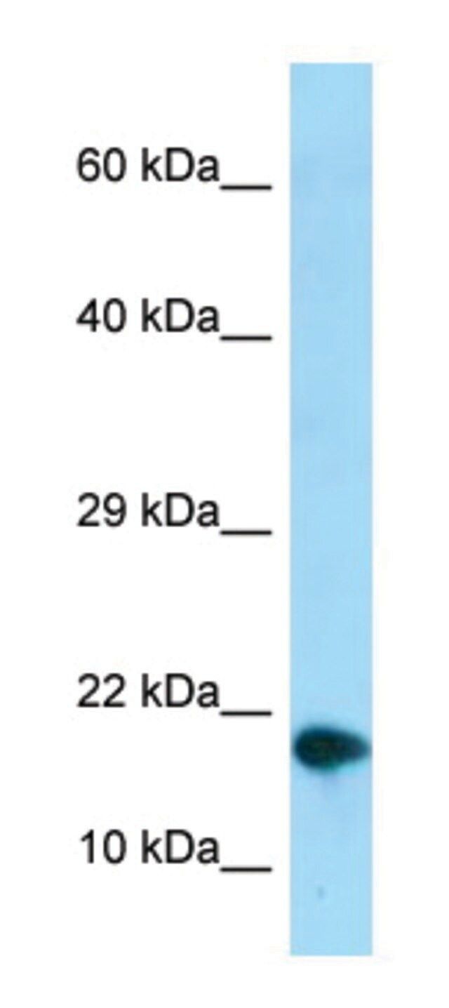 Anti-NUPR1 (C-terminal) antibody produced in rabbit