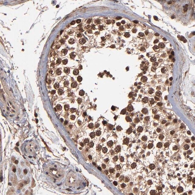 Anti-NXF2B antibody produced in rabbit