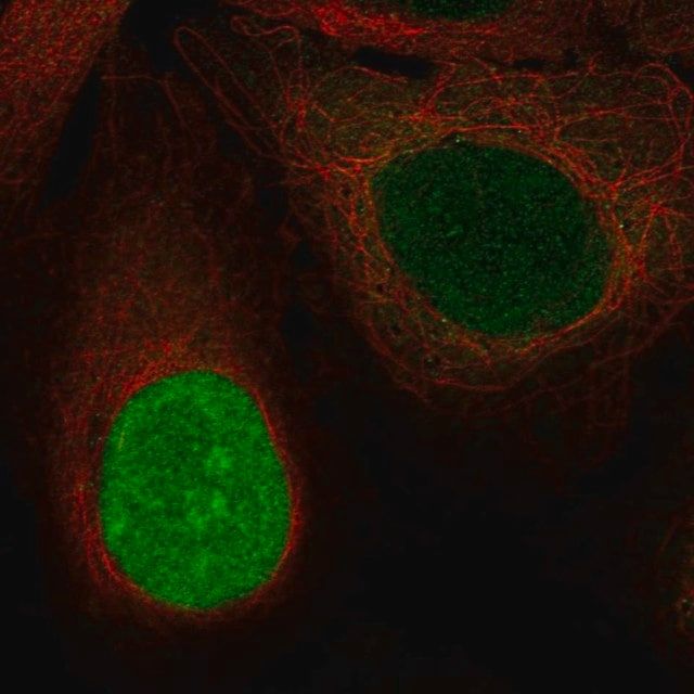 Anti-NUSAP1 antibody produced in rabbit