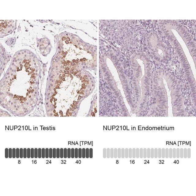 Anti-NUP210L antibody produced in rabbit