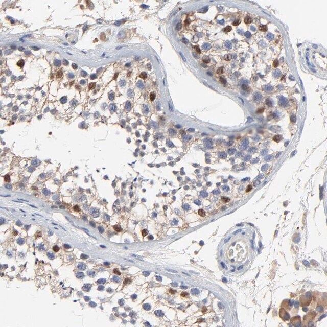 Anti-NXF3 antibody produced in rabbit