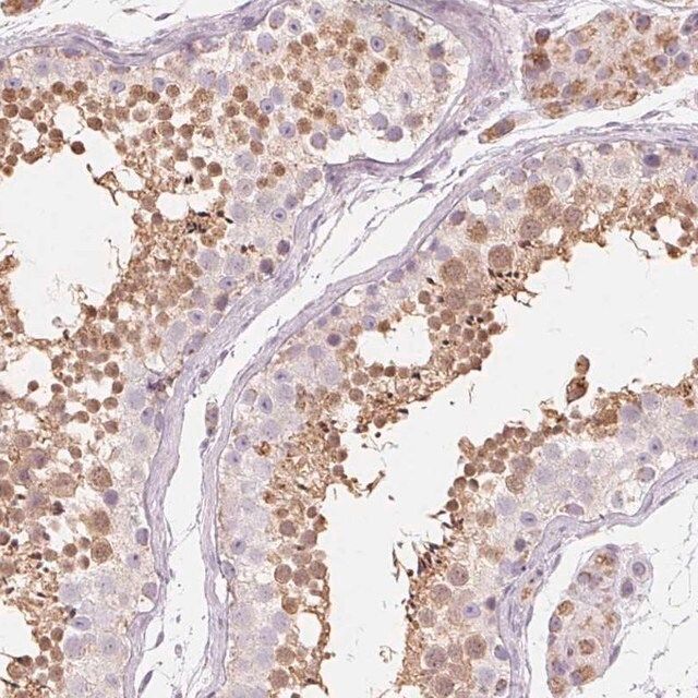Anti-NUP210L antibody produced in rabbit