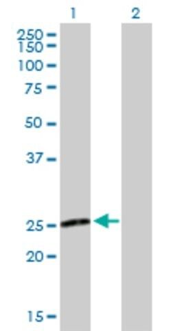 Anti-NXNL1 antibody produced in mouse