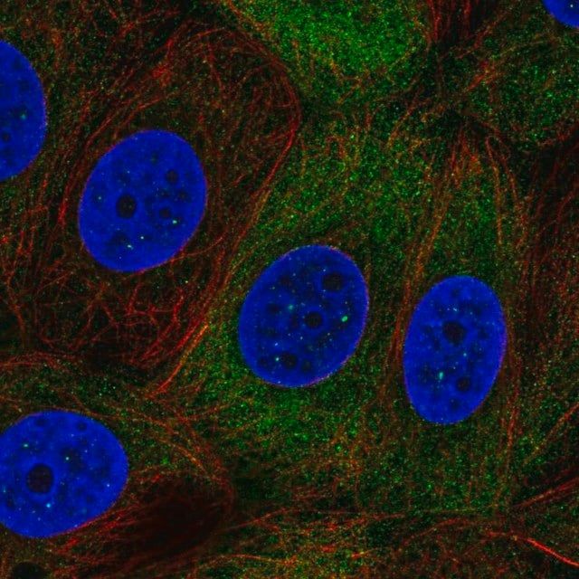 Anti-NUP210L antibody produced in rabbit