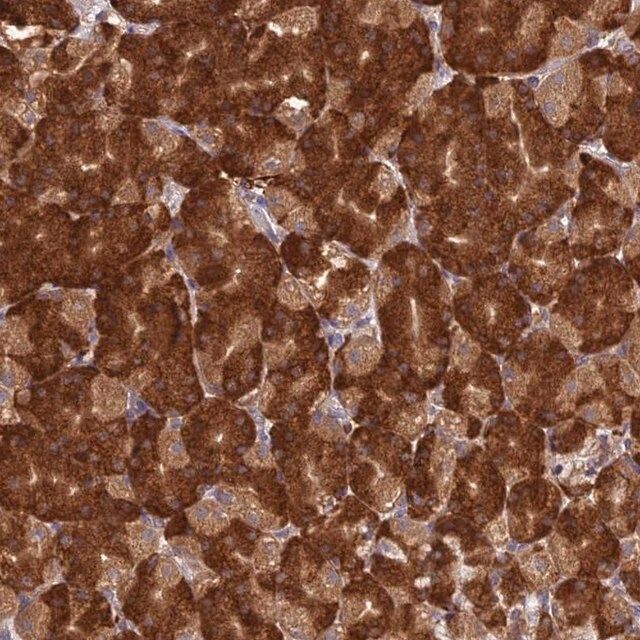 Anti-NXNL2 antibody produced in rabbit