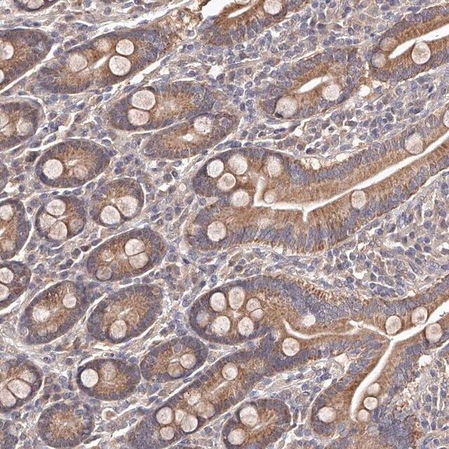 Anti-ODF2L antibody produced in rabbit