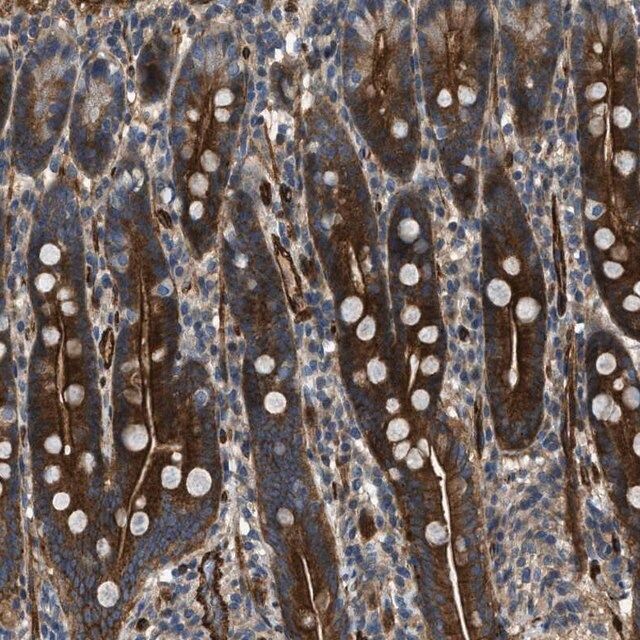 Anti-NYNRIN antibody produced in rabbit