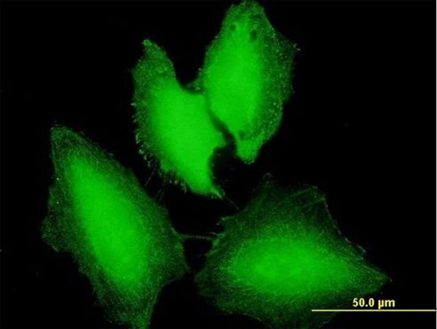 Anti-NXT1 antibody produced in mouse