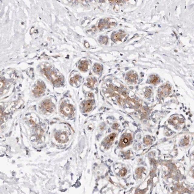 Anti-ODF2L antibody produced in rabbit