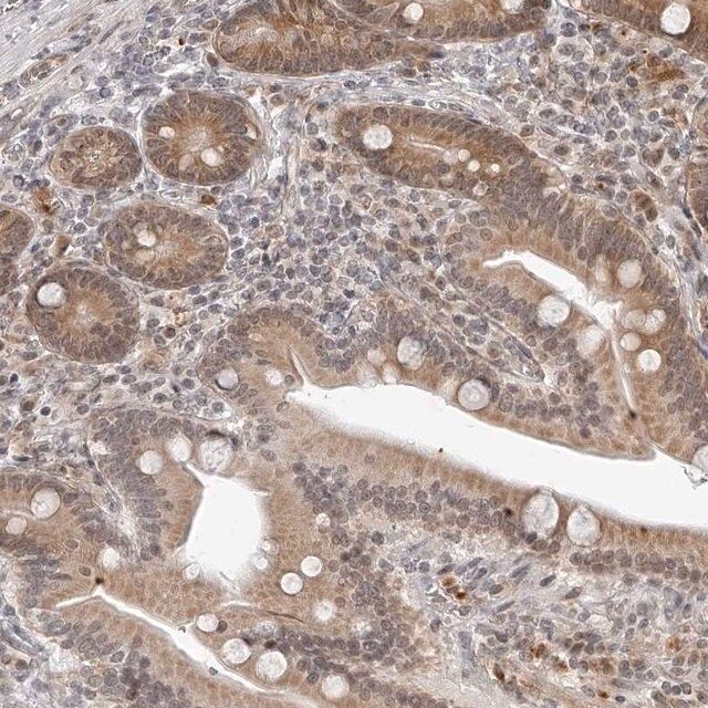 Anti-ODF2L antibody produced in rabbit