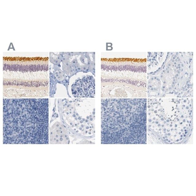 Anti-OPN1SW antibody produced in rabbit