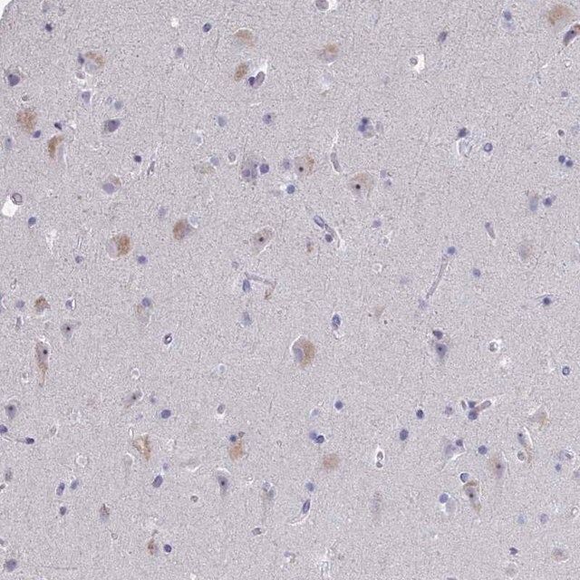 Anti-NOXRED1 antibody produced in rabbit