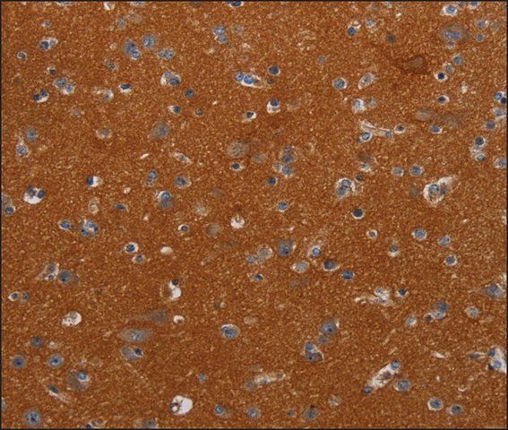 Anti-NOX3 antibody produced in rabbit