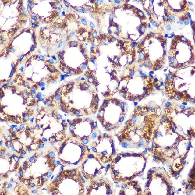 Anti-NOXA2/p67phox antibody produced in rabbit