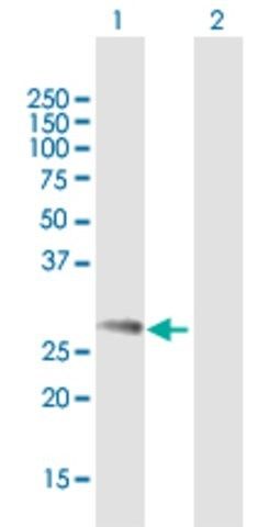 Anti-NDFIP1 antibody produced in mouse