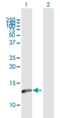 Anti-NDUFA5 antibody produced in mouse
