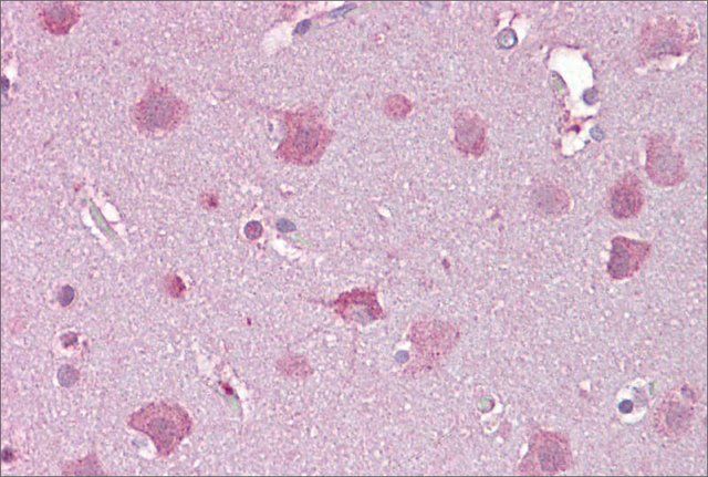 Anti-NDP antibody produced in rabbit