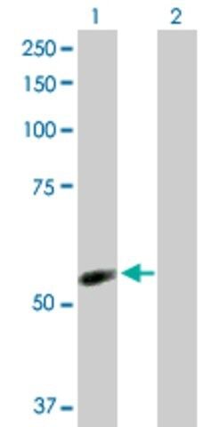 Anti-NDOR1 antibody produced in rabbit