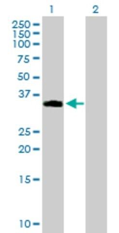 Anti-NDFIP2 antibody produced in mouse