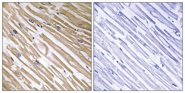 Anti-NDRG4 antibody produced in rabbit