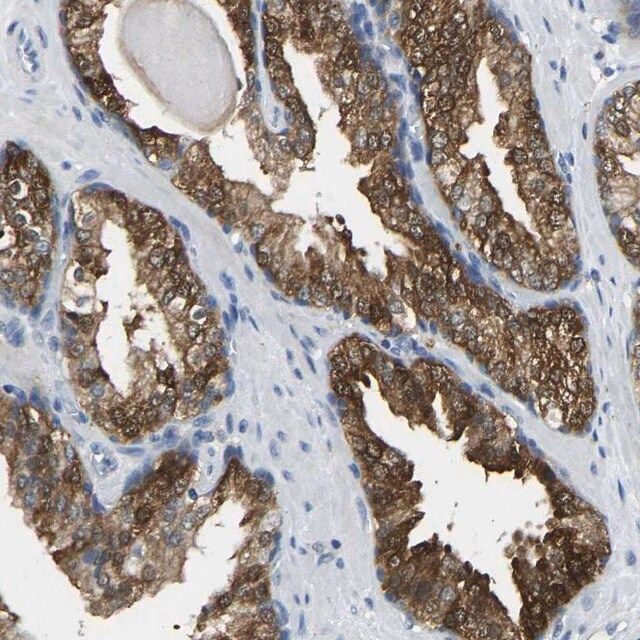 Anti-NDRG3 antibody produced in rabbit