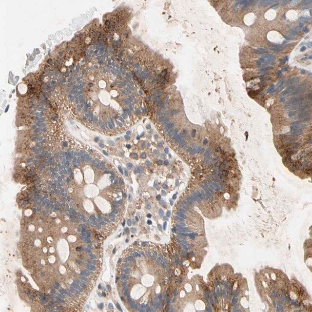 Anti-NDFIP2 antibody produced in rabbit