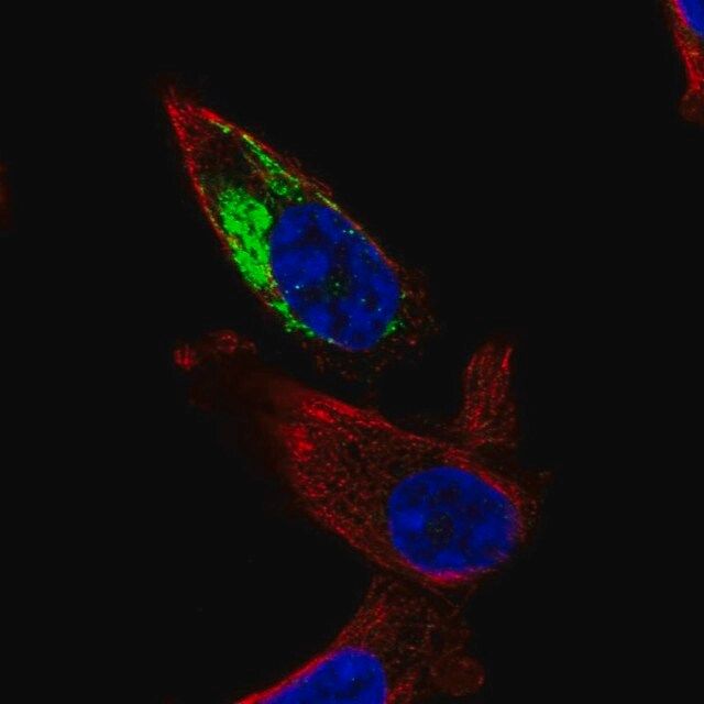 Anti-NDUFA11 antibody produced in rabbit