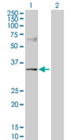 Anti-NDRG2 antibody produced in rabbit