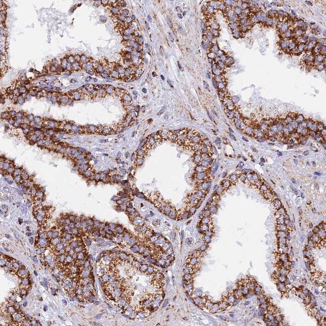 Anti-NDUFB6 antibody produced in rabbit