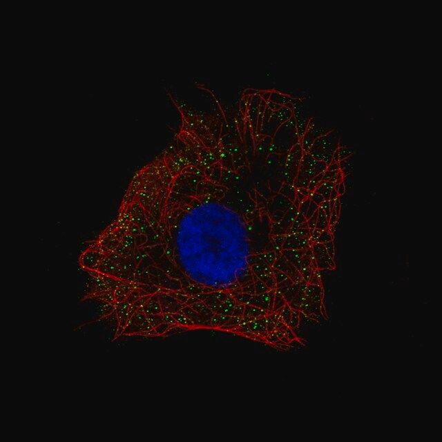 Anti-NDP antibody produced in rabbit