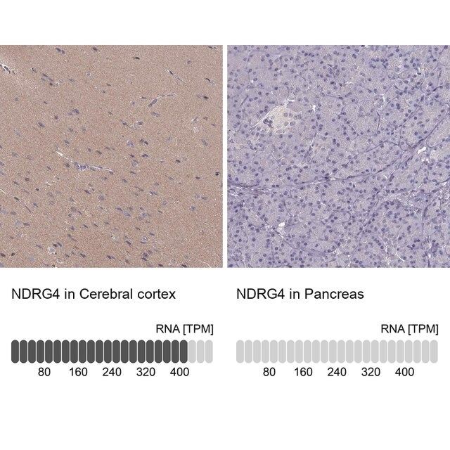 Anti-NDRG4 antibody produced in rabbit