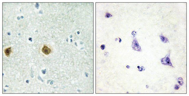 Anti-NDUC2 antibody produced in rabbit