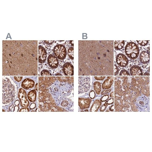 Anti-NDUFA8 antibody produced in rabbit