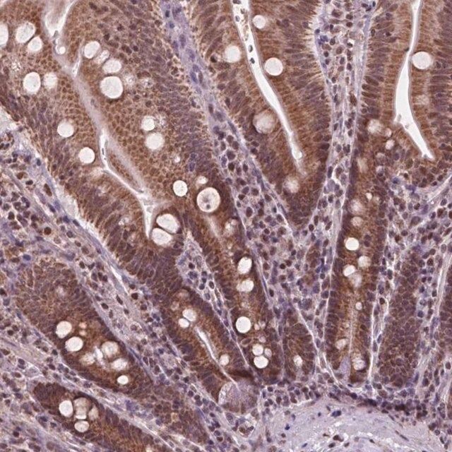 Anti-NDUFA10 antibody produced in rabbit