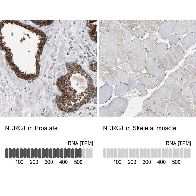 Anti-NDRG1 antibody produced in rabbit
