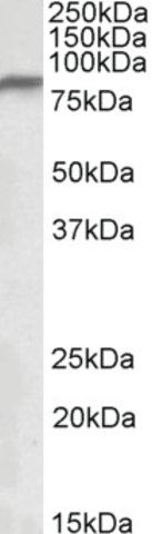 Anti-NDUFS1 antibody produced in goat