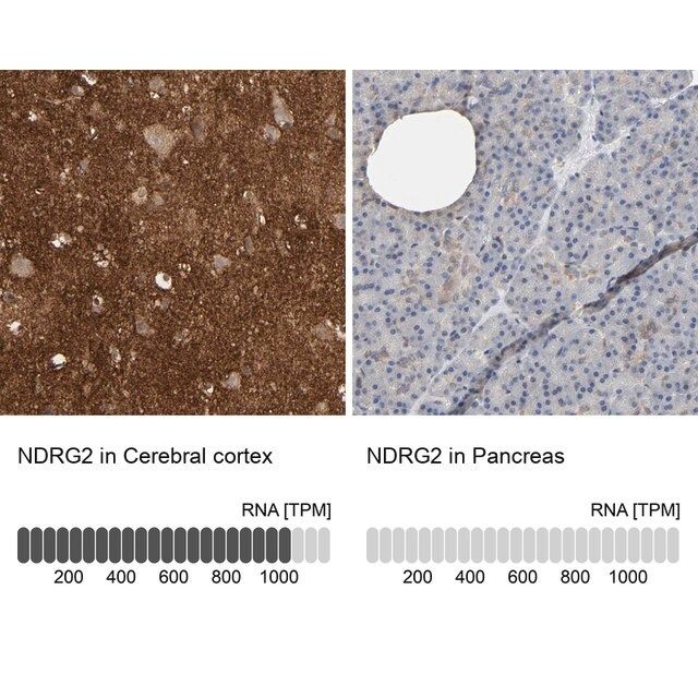 Anti-NDRG2 antibody produced in rabbit