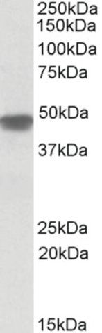 Anti-NDUFS2 antibody produced in goat