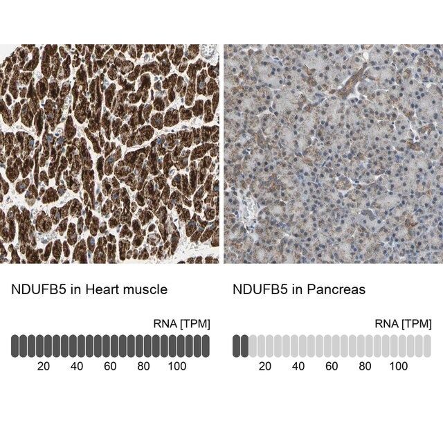 Anti-NDUFB5 antibody produced in rabbit