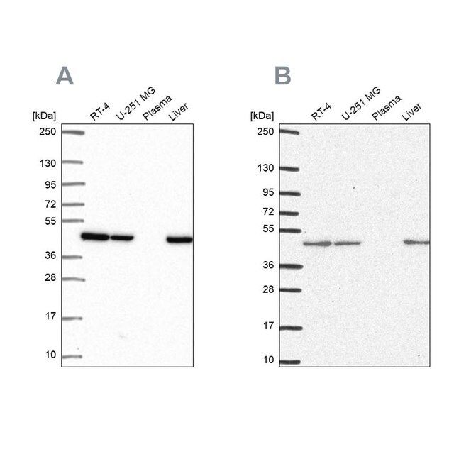 Anti-NDUFS2 antibody produced in rabbit